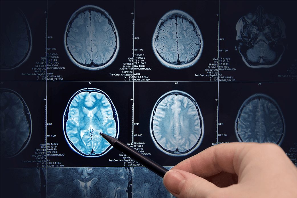 program to view mri images